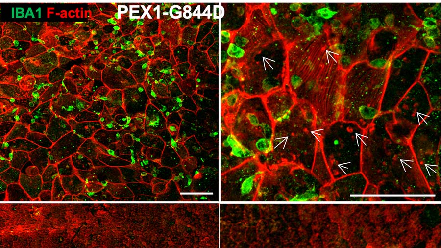 Early lipid changes drive retinal degeneration in Zellweger spectrum disorder