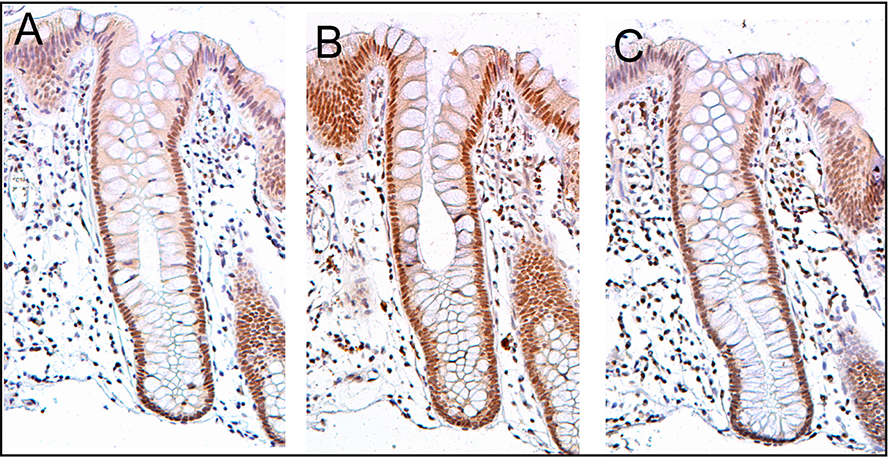 The colon’s interior contains numerous crypts, or pockets, each filled with cells that derive from a handful of stem cells confined to each crypt. These structures make the colon an ideal place to study the evolution of mutant clones.