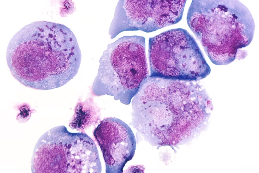 Inclusion bodies, stained magenta in this micrograph of herpesvirus 6, are aggregates of proteins that form a type of biomolecular condensate.