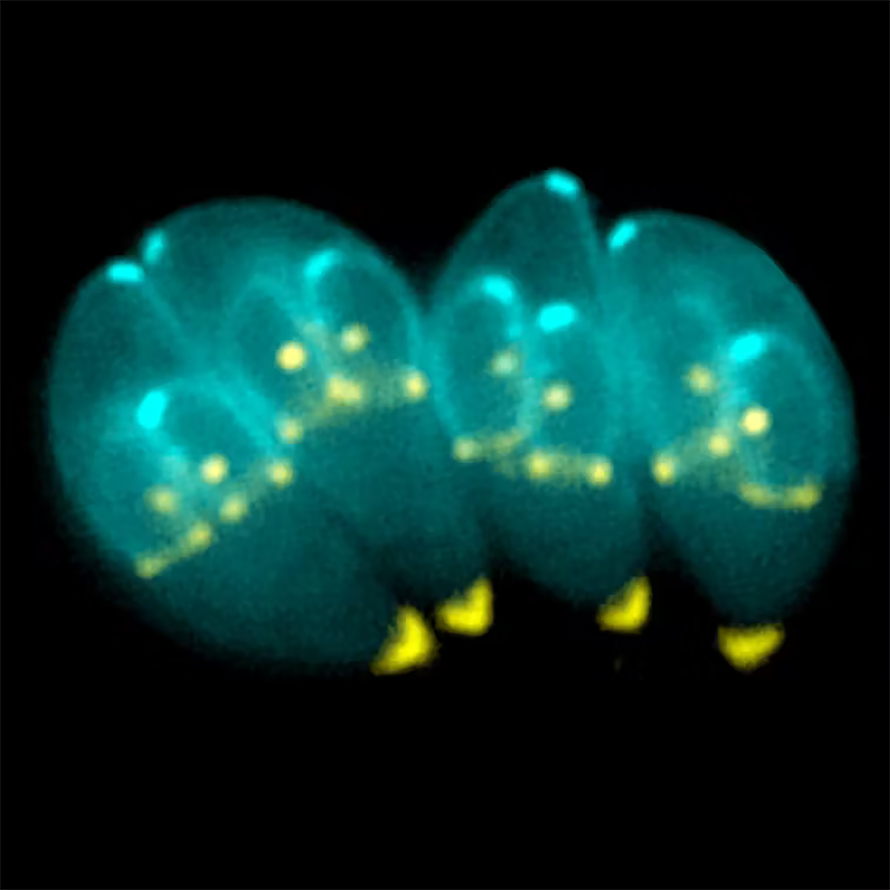 The task scientists face is to modify Toxoplasma to safely penetrate the brain.