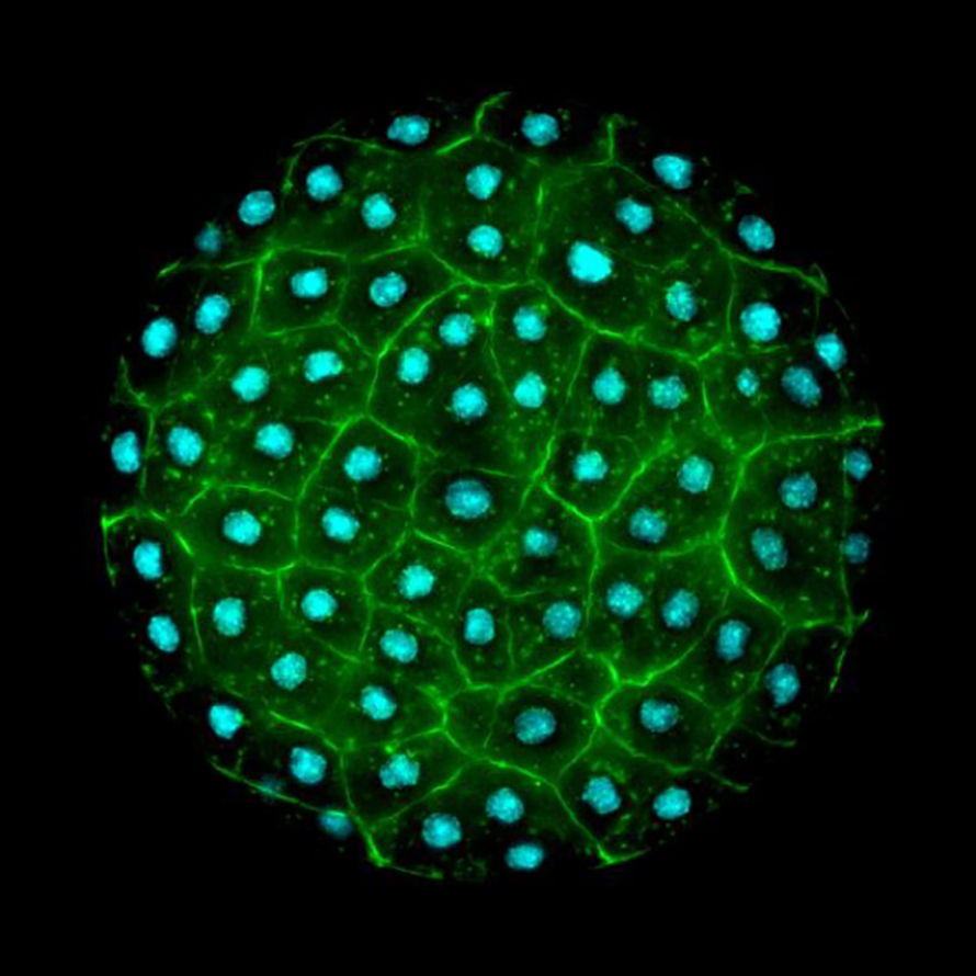 Ichthyosporeans generate structures with many nuclei before separating into individual cells. This species, Sphaeroforma arctica, was found in an Arctic crustacean.