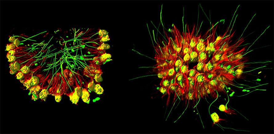 The choanoflagellate Choanoeca flexa can group together into colonies, with the tail structures either pointing in or out. The colonies switch to the tail-out shape in response to sudden darkness. These relatives of multicellular animals were discovered in splash pools on the Caribbean island of Curaçao and were christened “flexa” for the bendy sheet-like structures they formed.