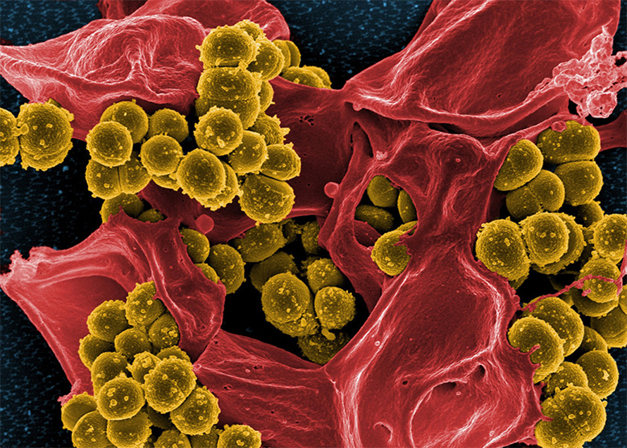 Antibiotic resistance is a growing problem. This photo shows methicillin-resistant Staphylococcus aureus (yellow) — one of the most serious resistant pathogens — and a dead human white blood cell (red). Researchers have had some success in reversing antibiotic resistance by treating infected patients with particular bacteriophages.