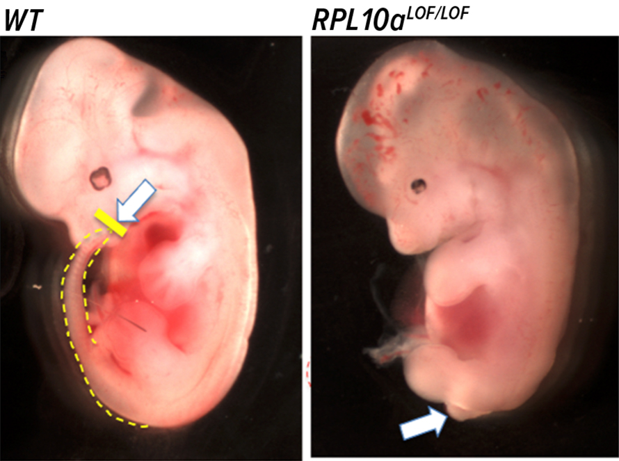 Mouse embryos with faulty versions of the ribosomal protein gene Rpl10a don’t develop a tail. On the left is a normal embryo; on the right is the mutant embryo.