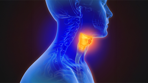 Pan-kinase inhibitor for head and neck cancer enters clinical trials