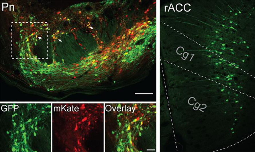 This image shows that the cells in yellow in the pons (left) receive input from the green cells in the cingulate cortex (rACC, right), with subdivisions Cg1 and Cg2.