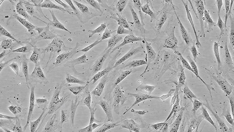 Generating the 3T3 cell line, the oncogene hypothesis and horses