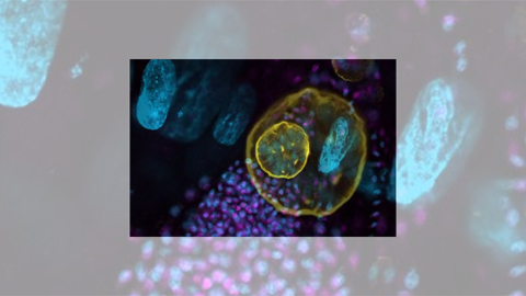 Toxoplasma gondii parasite uses unconventional method to make proteins for evasion of drug treatment