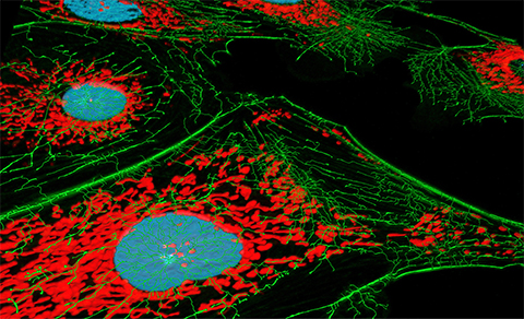 Actin can form long microfilaments or exists as diffuse monomers, as seen in green in these fibroblast cells.