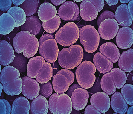 Neisseria gonorrhoeae bacteria may have driven the evolution of human gene variants that protect against dementia.