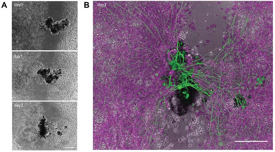 Diagram A shows an anthrobot building a bridge across a scratched neuron over the course of three days. Diagram B highlights the ‘stitch’ in green at the end of Day 3.