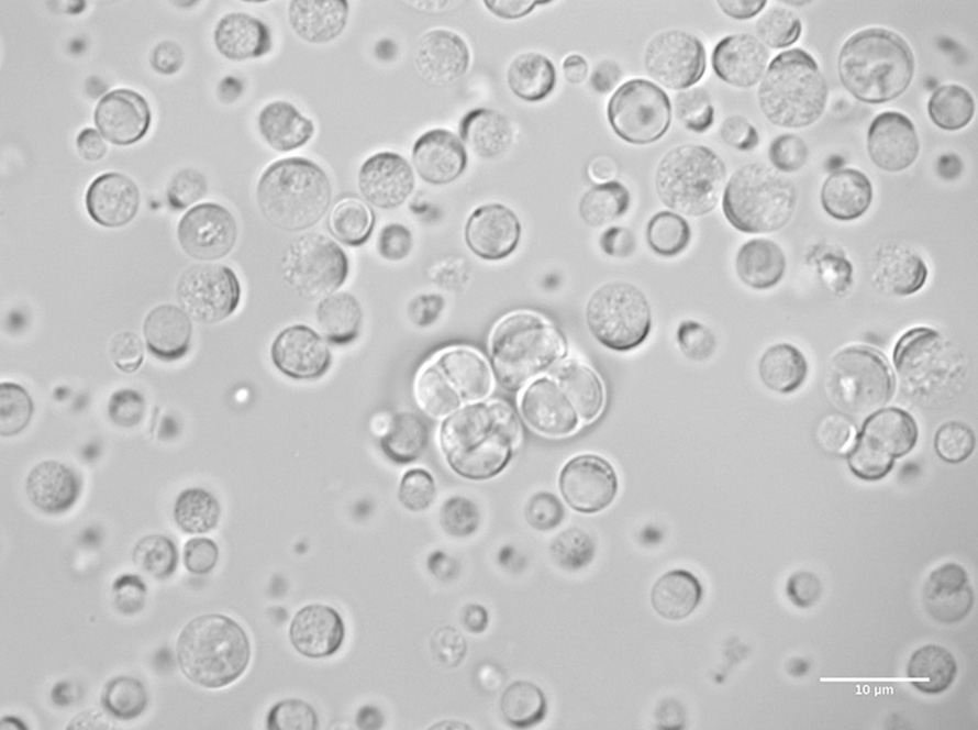 Corallochytrium limacisporum exist as single cells with one or more nuclei. This free-living species was first discovered in lagoons of islands in the Arabian Sea.