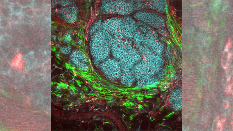 How opposing metabolic pathways regulate inflammation