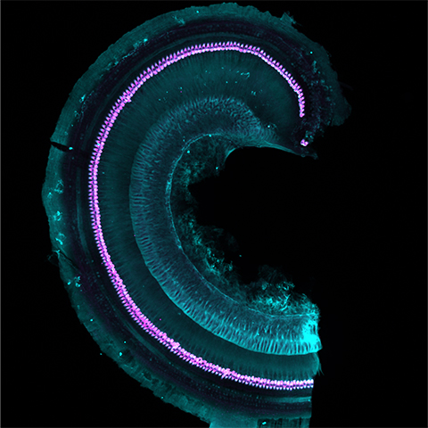 Apical turn of an organ of Corti of an adult mouse, showing VGluT3 expression, magenta, in inner hair cells.