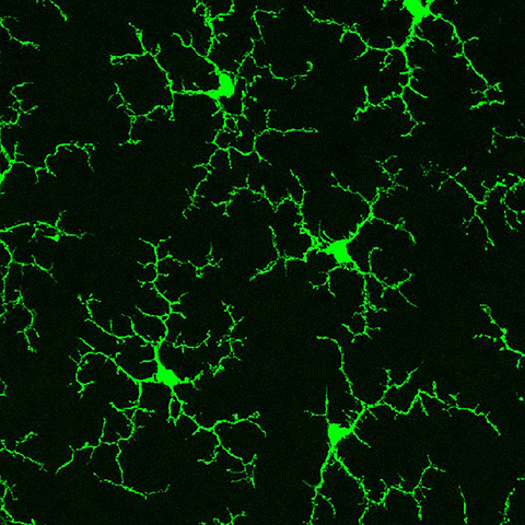 Microglia in the retina of a healthy adult mouse.