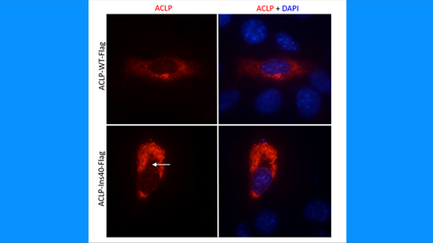 Decoding a protein’s role in connective tissue disorders