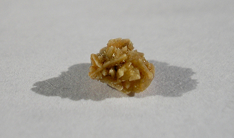 For Guarracino, a kidney stone like this one reinforced the importance of drinking enough water.