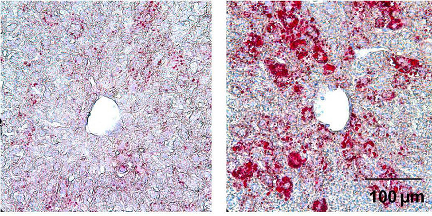 Lipid accumulation in the livers of unaltered mice fed a normal diet and treated with control adenovirus (left) or a liver-specific Klf2-overexpressing adenovirus Ad-ALB-Klf2 (right).