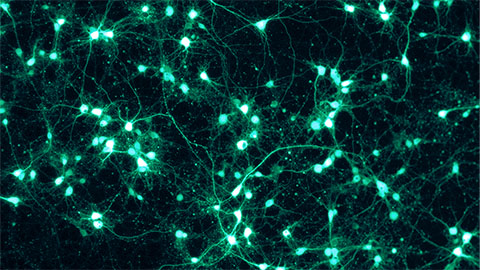 Uncovering the mechanisms of a glycosylation disorder
