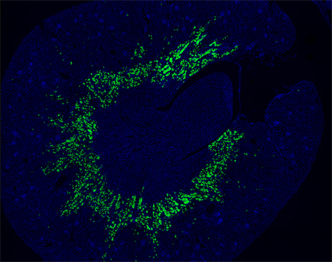 A cross-sectional view of the preclinical model’s kidney revealing that the omega-3 lysolipid transporter Mfsd2a (green color) is found specifically in the S3 segment of the proximal tubules