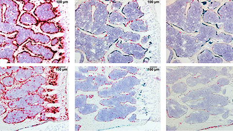 Bridging the gap – enhancing and unifying bone RNA-seq data