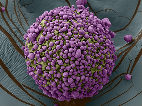 A polymer coating (green) stabilizes the micronutrients and protects them from heat degradation — a common side effect in cooking. The starch (purple) on the outside makes the particle more “flowable,” facilitating its incorporation into foodstuffs such as flour or bouillon cubes. Upon digestion, the particles break down, allowing the stable nutrients to be absorbed into the body.