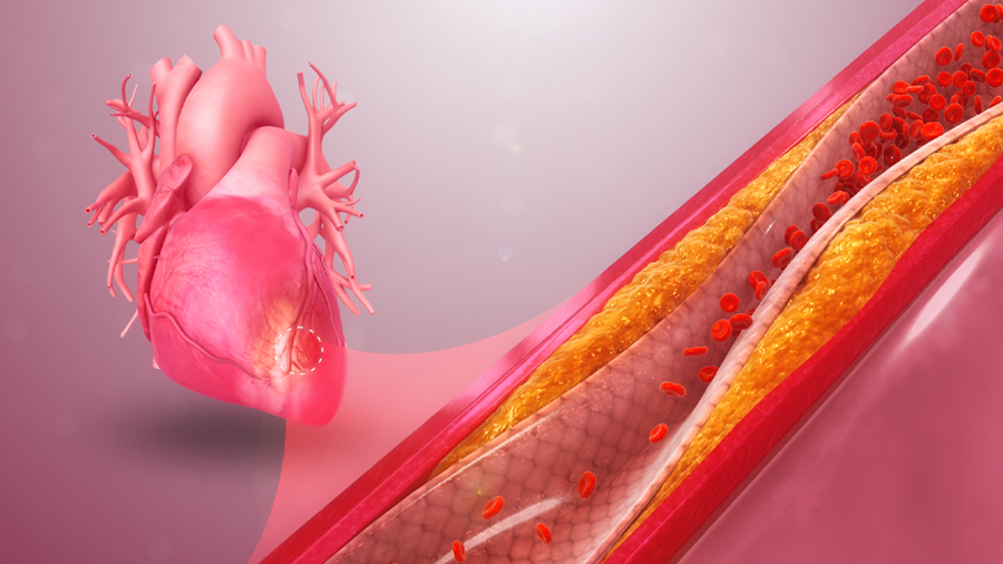 Scientists find unexpected correlation between age and HDL-C levels