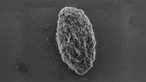 Using 'nature’s mistakes' as a window into Lafora disease