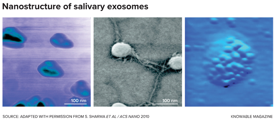 Although often described as “little bubbles,” exosomes are not necessarily perfect, solitary spheres. In the first image, taken with an atomic force microscope, lobes or waves are observed. In the second, taken with a field emission scanning electron microscope, connections between exosomes are visualized. The third, an electron microscopy image, shows the external “roughness” of the exosome due to the presence of proteins on its surface.