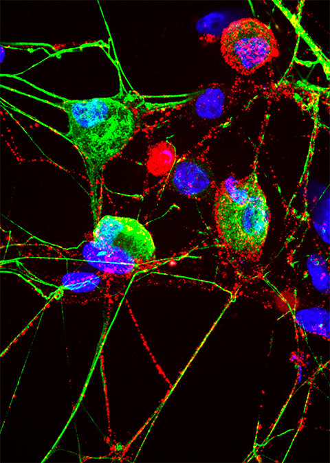 Neuronal membrane proteasomes are labeled with a red compound and appear in a subset of sensory neurons that are labeled with green compound. Note, not all green labeled neurons have the red label, which can appear in other unique dorsal root ganglion neurons that do not label with green. Blue staining is the nuclei of cells in the culture dish.