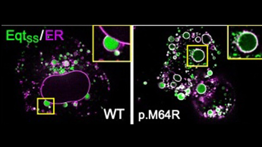 Homeostasis of sphingomyelin synthesis and subcellular distribution