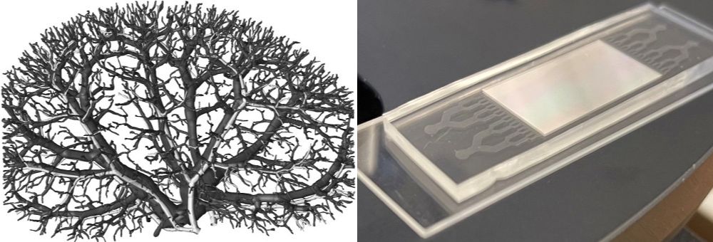 Images of arterial system and microfluidic device