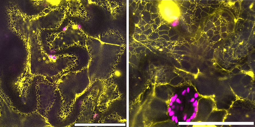 Estas imágenes de microscopía confocal fueron producidas por biólogos del Laboratorio Brookhaven en el Centro de Nanomateriales Funcionales.  Los investigadores etiquetaron las proteínas CB5D y similares a CB5D con una proteína fluorescente amarilla para visualizar su distribución dentro de las células vegetales.  Las imágenes ayudaron a los investigadores a confirmar que la proteína similar a CB5D de un tipo antiguo de hepática (derecha) estaba localizada en las mismas estructuras subcelulares que la proteína CB5D moderna (izquierda).