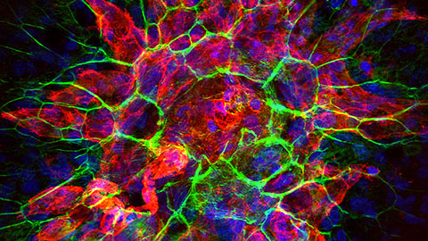 A biological camera: How AI is transforming retinal imaging