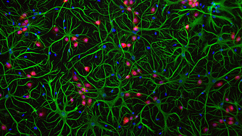 Key regulator of cholesterol protects against Alzheimer’s disease
