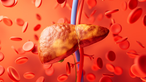 Cholesterol regulatory genes predict liver transplant outcomes